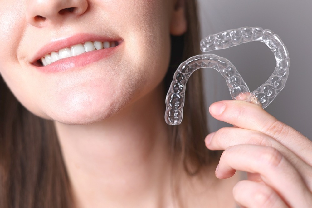 Clear Teeth Aligners an alternative to regular braces for getting a beautiful smile.