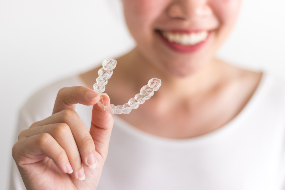 smile teeth aligners