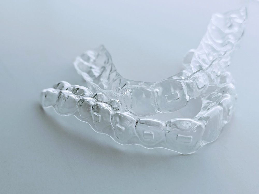 Clear Aligners