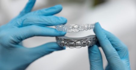 Aligners vs Braces